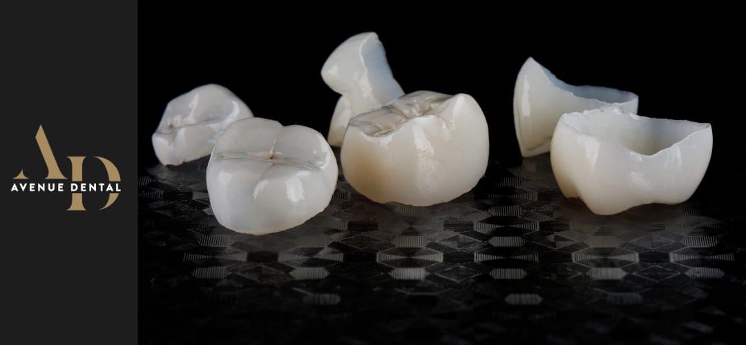 disadvantages of dental crowns - photo with dental crowns disadvantages of dental crowns - photo with dental crowns