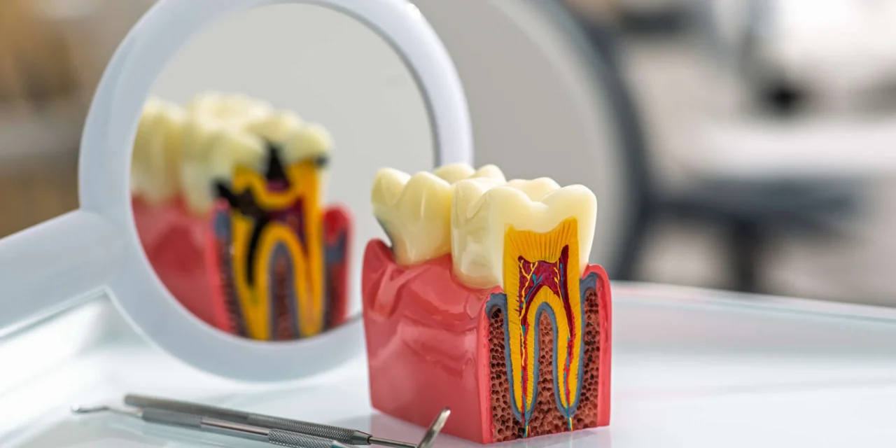 Tooth Enamel Erosion: Causes and How to Stop It